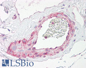 Anti-PGLS / 6PGL Antibody (aa191-240) IHC-plus LS-B7685