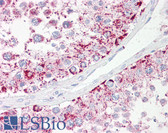 Anti-ABHD4 Antibody (aa251-300) IHC-plus LS-B7686