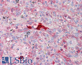 Anti-CA1 / Carbonic Anhydrase I Antibody (aa41-90) IHC-plus LS-B7692