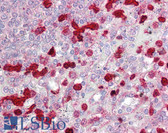 Anti-CLIC4 Antibody (aa1-50) IHC-plus LS-B7695