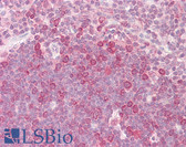 Anti-HELO1 / ELOVL5 Antibody (aa250-299) IHC-plus LS-B7696