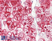 Anti-SLC16A12 / MCT12 Antibody (aa115-164) IHC-plus LS-B7700