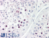 Anti-RFX3 Antibody (aa641-690) IHC-plus LS-B7703