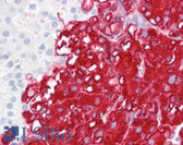 Anti-TPH1 / TPH Antibody IHC-plus LS-B7709