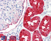 Anti-DDC / DOPA Decarboxylase Antibody (N-Terminus) IHC-plus LS-B7710