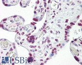 Anti-TP53 / p53 Antibody (aa283-332) IHC-plus LS-B7722