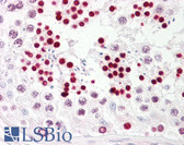 Anti-TP53 / p53 Antibody (aa344-393) IHC-plus LS-B7723