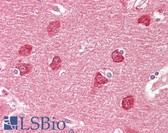 Anti-GPR20 Antibody (aa291-340) IHC-plus LS-B7724