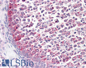 Anti-CASP9 / Caspase 9 Antibody (aa266-315) IHC-plus LS-B7727