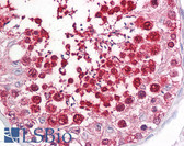 Anti-LMNA / Lamin A/C Antibody (aa181-230) IHC-plus LS-B7728