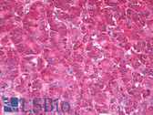 Anti-HDAC4 Antibody IHC-plus LS-B7737