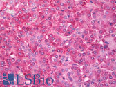 Anti-HDAC4 Antibody IHC-plus LS-B7738