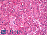 Anti-HDAC5 Antibody IHC-plus LS-B7739