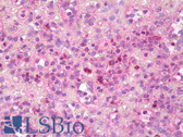 Anti-VEGFC Antibody IHC-plus LS-B7744