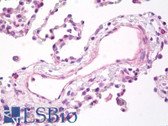 Anti-TGFBR2 Antibody IHC-plus LS-B7745