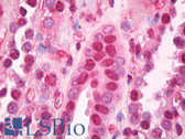 Anti-B2M / Beta 2 Microglobulin Antibody (clone 3F9-2C2) IHC-plus LS-B7757