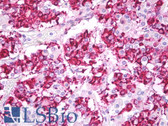 Anti-PRL / Prolactin Antibody (clone PRL02) IHC-plus LS-B7764