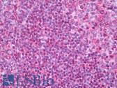 Anti-HLA-DR Antibody (clone LN3) IHC-plus LS-B7766