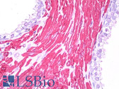 Anti-CALD1 / Caldesmon Antibody (clone h-CALD) IHC-plus LS-B7769