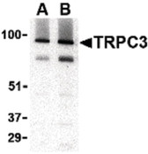 Anti-TRPC3 Antibody (C-Terminus) IHC-plus LS-B187