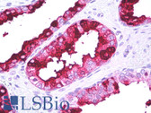 Anti-B3GAT1 Antibody (clone HNK-1) IHC-plus LS-B7771