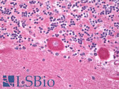 Anti-TRPV3 Antibody (C-Terminus) IHC-plus LS-B7773