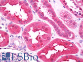 Anti-DKK4 Antibody (N-Terminus) IHC-plus LS-B7774