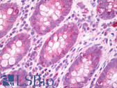 Anti-GJA3 / CX46 / Connexin 46 Antibody (N-Terminus) IHC-plus LS-B7775