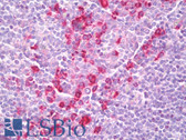 Anti-PHACTR2 Antibody (N-Terminus) IHC-plus LS-B7783