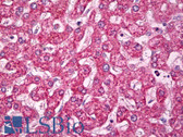 Anti-BCAR3 Antibody IHC-plus LS-B7811