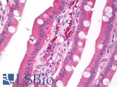 Anti-ZCCHC14 Antibody IHC-plus LS-B7814
