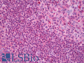 Anti-WAPAL / WAPL Antibody IHC-plus LS-B7816