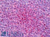 Anti-IFI16 Antibody IHC-plus LS-B7817