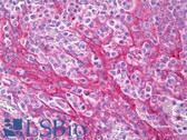 Anti-IQSEC1 Antibody IHC-plus LS-B7818