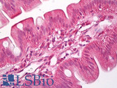 Anti-Carom / FCHSD2 Antibody IHC-plus LS-B7824