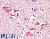Anti-PLCG1 Antibody (clone 2B1) IHC-plus LS-B7825