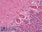 Anti-SOGA1 Antibody IHC-plus LS-B7833