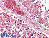 Anti-GPX4 / MCSP Antibody (clone 1H11) IHC-plus LS-B7835