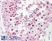 Anti-CSNK2A1 Antibody IHC-plus LS-B7844
