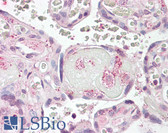 Anti-LYN Antibody (aa39-58) IHC-plus LS-B7849