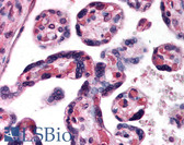 Anti-DKK1 Antibody (C-Terminus) IHC-plus LS-B194
