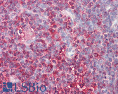 Anti-CFL1 / Cofilin Antibody (clone AF2C2) IHC-plus LS-B7855