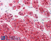 Anti-UCHL3 Antibody IHC-plus LS-B7856