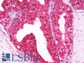 Anti-MTOR Antibody (C-Terminus, clone Y391) IHC-plus LS-B7865