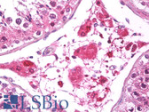 Anti-FABP3 / H-FABP Antibody (Internal, clone EPR6127) IHC-plus LS-B7867