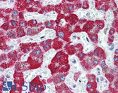 Anti-FANCD2 Antibody (clone 103) IHC-plus LS-B195