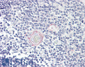 Anti-IL12B / IL12 p40 Antibody (clone C8.6) IHC-plus LS-B7873