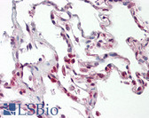 Anti-CDw218a / IL18R1 Antibody (clone H44) IHC-plus LS-B7874