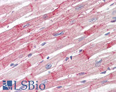 Anti-Nestin Antibody (clone 10C2) IHC-plus LS-B7877