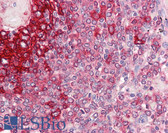 Anti-HLA-DR Antibody (clone LN3) IHC-plus LS-B7879